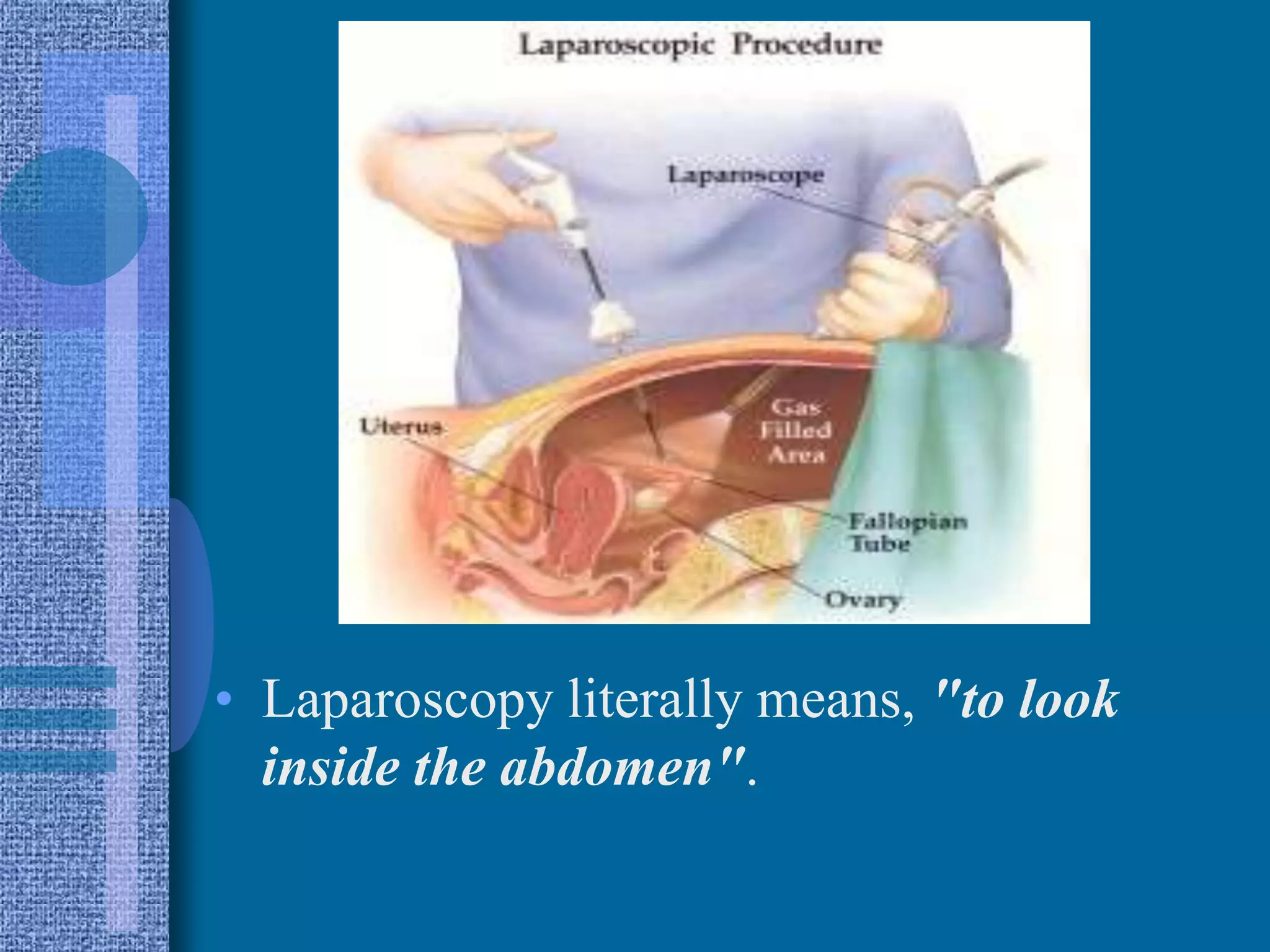 Laproscopy Incision Infected Gynaecological laproscopy | PPTX