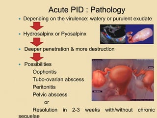 Acute PID : Pathology
 Depending on the virulence: watery or purulent exudate
 Hydrosalpinx or Pyosalpinx
 Deeper penetration & more destruction
 Possibilities
Oophoritis
Tubo-ovarian abscess
Peritonitis
Pelvic abscess
or
Resolution in 2-3 weeks with/without chronic
sequelae
 