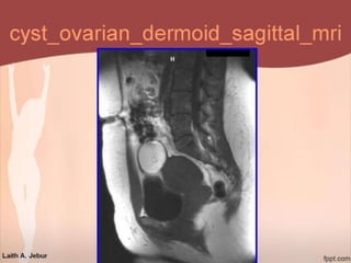 imaging of Gynaecology and obstetrics | PPSX