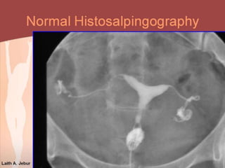 imaging of Gynaecology and obstetrics | PPSX