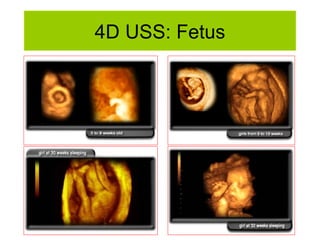 4D USS: Fetus 