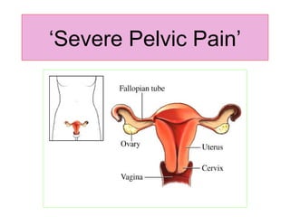 ‘ Severe Pelvic Pain’ 