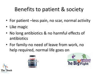 Benefits to patient & society
• For patient –less pain, no scar, normal activity
• Like magic
• No long antibiotics & no harmful effects of
antibiotics
• For family-no need of leave from work, no
help required, normal life goes on
 