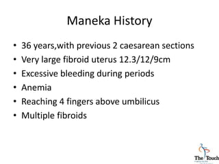 Maneka History
• 36 years,with previous 2 caesarean sections
• Very large fibroid uterus 12.3/12/9cm
• Excessive bleeding during periods
• Anemia
• Reaching 4 fingers above umbilicus
• Multiple fibroids
 