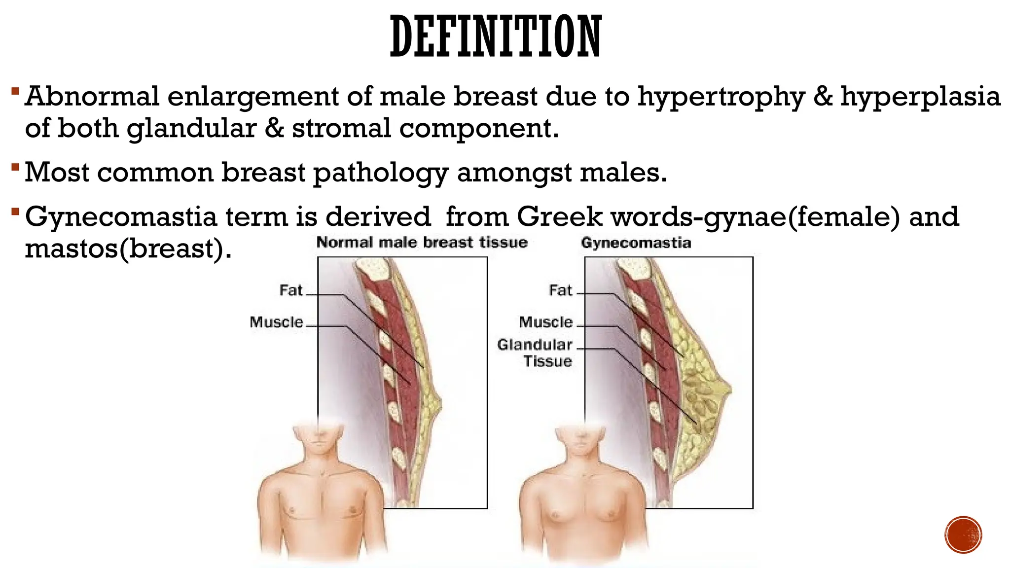 can bpc 157 cause gyno GYNAECOMASTIA- diagnosis and management Quantity:60 Lifestar Pharma BPC-157 PURE by Integrative