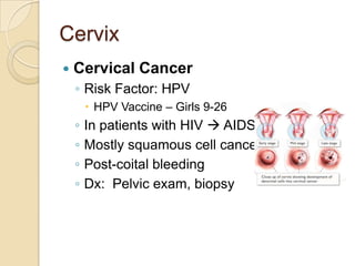Cervix


Cervical Cancer
◦ Risk Factor: HPV
 HPV Vaccine – Girls 9-26

◦
◦
◦
◦

In patients with HIV  AIDS
Mostly squamous cell cancers
Post-coital bleeding
Dx: Pelvic exam, biopsy

 