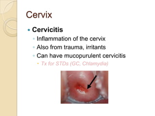 Cervix


Cervicitis
◦ Inflammation of the cervix
◦ Also from trauma, irritants
◦ Can have mucopurulent cervicitis
 Tx for STDs (GC, Chlamydia)

 