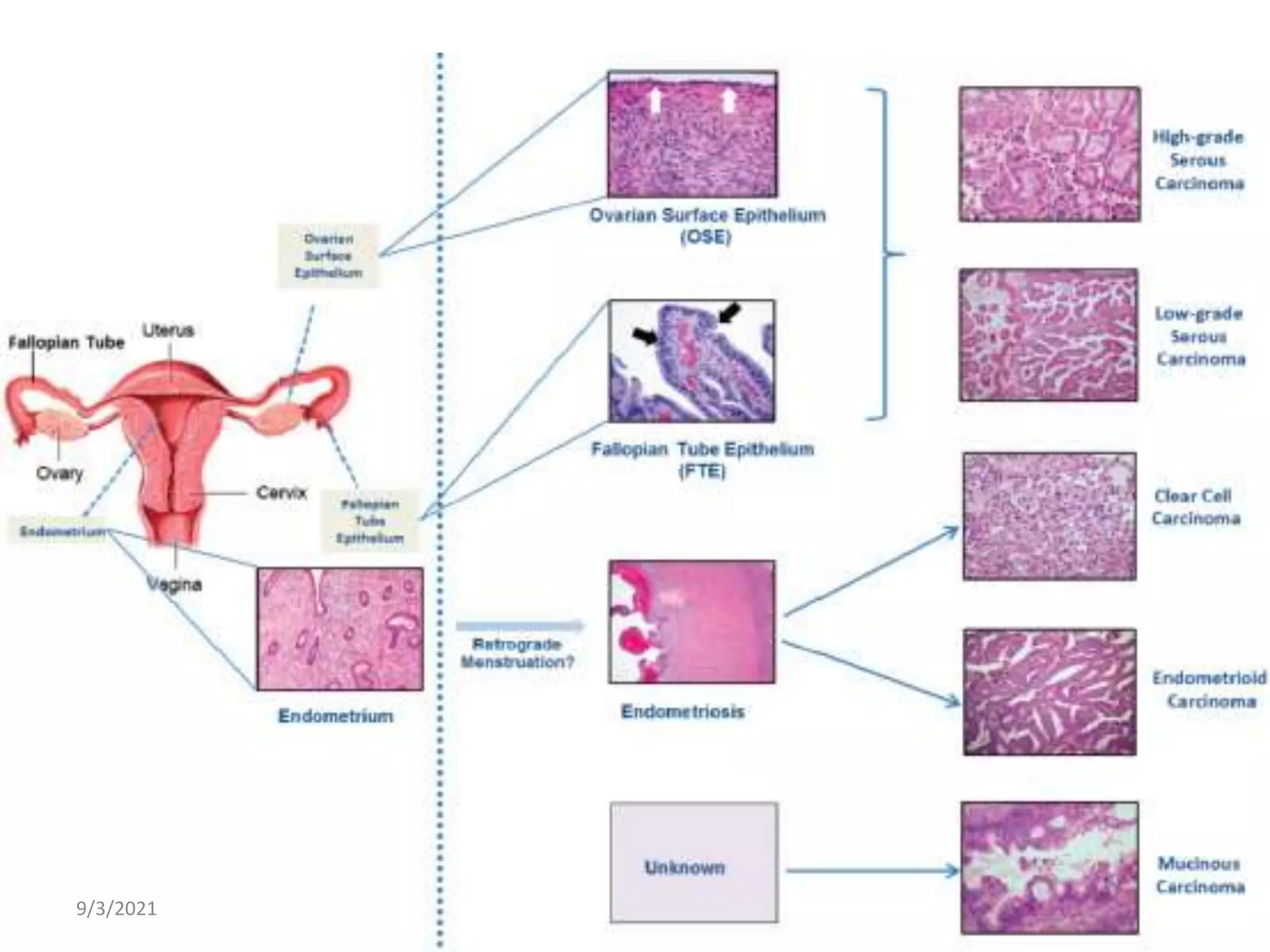 Gyne oncology refresher series 1 | PPT