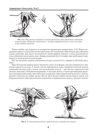 Акушерство і гінекологія. Том 2




         Рис. 1.4. Обстеження зовнішніх статевих органів (вульва, промежина, зовнішній
      отвір уретри). Обережне натиснення в ділянці парауретральних залоз для вияв
      лення гнійних виділень


   Піхву і шийку досліджують за допомогою спеціальних дзеркал (рис. 1.5). Перед уве
денням дзеркал у піхву (під кутом приблизно 45°) необхідно забезпечити розслаблення
м’язів леваторів. Для цього застосовують такий прийом: вводять у піхву вказівний па
лець і обережно натискають униз. Дзеркала повинні бути теплими, при необхідності про
водять їх зволоження теплою водою.
   Під час введення дзеркал визначають колір, складчастість, наявність об’ємних мас у
піхві.
   При обстеженні шийки матки звертають увагу на її форму, вигляд зовнішнього зіва,
колір, наявність поліпів. У жінок, які не народжували через природні пологові шляхи,
зовнішній зів округлий; у жінок, які мали піхвові пологи — має вигляд горизонтальної
щілини, можливо, з боковими надривами. У молодих жінок, а також при вживанні ораль
них контрацептивів може спостерігатися латеральне пересування межі плоского і цилінд
ричного епітелію на шийці матки. Після обстеження шийки матки беруть мазок для
мікроскопічного і бактеріологічного (звичайно з цервікального каналу, уретри і задньо




             Рис.1. 5. Дослідження піхви і шийки матки за допомогою дзеркал


                                            8
 