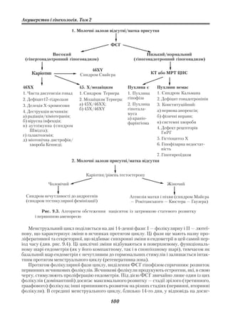 Акушерство і гінекологія. Том 2

                        1. Молочні залози відсутні/матка присутня


                                           ФСГ

              Високий                                        Низький/нормальний
 (гіпергонадотропний гіпогонадизм)                    (гіпогонадотропний гіпогонадизм)

                                 46XY
    Каріотип                Синдром Свайєра                      КТ або МРТ ЦНС


46ХХ                        45. Х/мозаїцизм         Пухлина є   Пухлини немає
1. Чиста дисгенезія гонад   1. Синдром Тернера      1. Пухлина  1. Синдром Кальмана
2. Дефіцит17 гідролази      2. Мозаїцизм Тернера:   гіпофіза    2. Дефіцит гонадотропінів
3. Делеція Х хромосоми      а) 45Х/46XX;            2. Пухлина  3. Конституційний:
                            б) 45X/46XY             гіпотала    а) нервова анорексія;
4. Деструкція яєчників:                             муса
а) радіація/хіміотерапія;                           а) краніо
                                                                б) фізичні вправи;
б) вірусна інфекція;                                фарінгіома  в) системні хвороби
в) аутоімунна (синдром                                          4. Дефект рецепторів
    Шмідта);                                                       ГнРГ
г) галактоземія;
д) міотонічна дистрофія/                                        5. Гістіоцитоз Х
    хвороба Кеннеді;                                            6. Гіпофізарна недостат
                                                                   ність
                                                                7. Гіпотиреоїдизм
                        2. Молочні залози присутні/матка відсутня


                               Каріотип/рівень тестостерону

            Чоловічий                                                  Жіночий

  Синдром нечутливості до андрогенів                Агенезія матки і піхви (синдром Майєра
  (синдром тестикулярної фемінізації)               — Рокітанського — Кюстера — Гаузера)

          Рис. 9.3. Алгоритм обстеження пацієнток із затримкою статевого розвитку
      і первинною аменореєю

   Менструальний цикл поділяється на дві 14 денні фази: І — фолікулярну і ІІ — лютеї
нову, що характеризує зміни в яєчниках протягом циклу. Ці фази ще мають назву про
ліферативної та секреторної, що відбиває синхронні зміни в ендометрії в цей самий пер
іод часу (див. рис. 9.4). Ці циклічні зміни відбуваються в поверхневому, функціональ
ному шарі ендометрія (як у його компактному, так і в спонгіозному шарі), тимчасом як
базальний шар ендометрія є нечутливим до гормональних стимулів і залишається інтак
тним протягом менструального циклу (регенеративна зона).
   Протягом фолікулярної фази циклу, виділення ФСГ гіпофізом спричинює розвиток
первинних яєчникових фолікулів. Яєчникові фолікули продукують естрогени, які, в свою
чергу, стимулюють проліферацію ендометрія. Під дією ФСГ звичайно лише один із цих
фолікулів (домінантний) досягає максимального розвитку — стадії зрілого (третинного,
граафового) фолікула; інші припиняють розвиток на різних стадіях (первинні, вторинні
фолікули). В середині менструального циклу, близько 14 го дня, у відповідь на досяг

                                           100
 