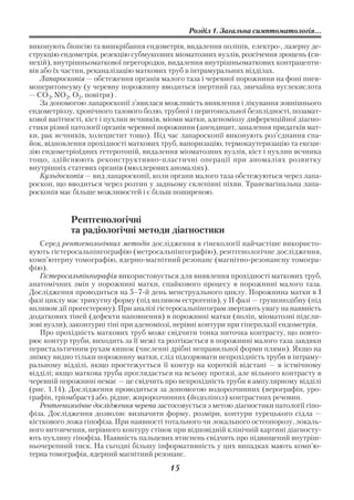 Розділ 1. Загальна симптоматологія...

виконують біопсію та вишкрібання ендометрія, видалення поліпів, електро , лазерну де
струкцію ендометрія, резекцію субмукозних міоматозних вузлів, розсічення зрощень (си
нехій), внутрішньоматкової перегородки, видалення внутрішньоматкових контрацепти
вів або їх частин, реканалізацію маткових труб в інтрамуральних відділах.
    Лапароскопія — обстеження органів малого таза і черевної порожнини на фоні пнев
моперитонеуму (у черевну порожнину вводиться інертний газ, звичайна вуглекислота
— СО 2, NО 2, О2 , повітря) .
    За допомогою лапароскопії з’явилася можливість виявлення і лікування зовнішнього
ендометріозу, хронічного тазового болю, трубної і перитонеальної безплідності, позамат
кової вагітності, кіст і пухлин яєчників, міоми матки, аденоміозу диференційної діагно
стики різної патології органів черевної порожнини (апендицит, запалення придатків мат
ки, рак яєчників, холецистит тощо). Під час лапароскопії виконують роз’єднання спа
йок, відновлення прохідності маткових труб, вапоризацію, термокаутеризацію та ексци
зію ендометріоїдних гетеротопій, видалення міоматозних вузлів, кіст і пухлин яєчника
тощо, здійснюють реконструктивно пластичні операції при аномаліях розвитку
внутрішніх статевих органів (мюллерових аномаліях).
    Кульдоскопія — вид лапароскопії, коли органи малого таза обстежуються через лапа
роскоп, що вводиться через розтин у задньому склепінні піхви. Трансвагінальна лапа
роскопія має більше можливостей і є більш поширеною.


            Рентгенологічні
            та радіологічні методи діагностики
   Серед рентгенологічних методів дослідження в гінекології найчастіше використо
вують гістеросальпінгографію (метросальпінгографію), рентгенологічне дослідження,
комп’ютерну томографію, ядерно магнітний резонанс (магнітно резонансну томогра
фію).
   Гістеросальпінгографія використовується для виявлення прохідності маткових труб,
анатомічних змін у порожнині матки, спайкового процесу в порожнині малого таза.
Дослідження проводиться на 5–7 й день менструального циклу. Порожнина матки в І
фазі циклу має трикутну форму (під впливом естрогенів), у II фазі — грушоподібну (під
впливом дії прогестерону). При аналізі гістеросальпінгограм звертають увагу на наявність
додаткових тіней (дефекти наповнення) в порожнині матки (поліп, міоматозні підсли
зові вузли), законтурні тіні при аденоміозі, нерівні контури при гіперплазії ендометрія.
   Про прохідність маткових труб може свідчити тонка ниточка контрасту, що повто
рює контур труби, виходить за її межі та розтікається в порожнині малого таза завдяки
перистальтичним рухам кишок (численні дрібні неправильної форми плями). Якщо на
знімку видно тільки порожнину матки, слід підозрювати непрохідність труби в інтраму
ральному відділі, якщо простежується її контур на короткій відстані — в істмічному
відділі; якщо маткова труба проглядається на всьому протязі, але вільного контрасту в
черевній порожнині немає — це свідчить про непрохідність труби в ампулярному відділі
(рис. 1.14). Дослідження проводиться за допомогою водорозчинних (верографін, уро
графін, тріомбраст) або, рідше, жиророзчинних (йодоліпол) контрастних речовин.
   Рентгенологічне дослідження черепа застосовується з метою діагностики патології гіпо
фіза. Дослідження дозволяє визначити форму, розміри, контури турецького сідла —
кісткового ложа гіпофіза. При наявності тотального чи локального остеопорозу, локаль
ного витончення, нерівного контуру стінок при відповідній клінічній картині діагносту
ють пухлину гіпофіза. Наявність пальцевих втиснень свідчить про підвищений внутріш
ньочерепний тиск. На сьгодні більшу інформативність у цих випадках мають комп’ю
терна томографія, ядерний магнітний резонанс.
                                          15
 