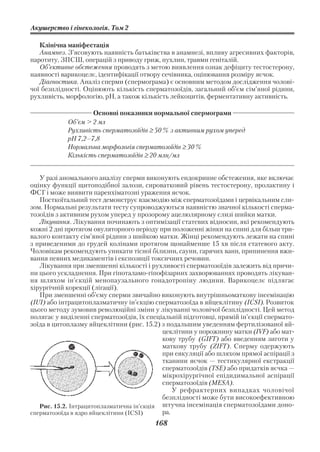 Акушерство і гінекологія. Том 2

   Клінічна маніфестація
   Анамнез. З’ясовують наявність батьківства в анамнезі, впливу агресивних факторів,
паротиту, ЗПСШ, операцій з приводу гриж, пухлин, травми геніталій.
   Об’єктивне обстеження проводять з метою виявлення ознак дефіциту тестостерону,
наявності варикоцелє, ідентифікації отвору сечівника, оцінювання розміру яєчок.
   Діагностика. Аналіз сперми (спермограма) є основним методом дослідження чолові
чої безплідності. Оцінюють кількість сперматозоїдів, загальний об’єм сім’яної рідини,
рухливість, морфологію, рН, а також кількість лейкоцитів, ферментативну активність.

                    Основні показники нормальної спермограми
            Об’єм > 2 мл
            Рухливість сперматозоїдів ≥ 50 % з активним рухом уперед
            рН 7,2–7,8
            Нормальна морфологія сперматозоїдів ≥ 30 %
            Кількість сперматозоїдів ≥ 20 млн/мл


   У разі аномального аналізу сперми виконують ендокринне обстеження, яке включає
оцінку функції щитоподібної залози, сироватковий рівень тестостерону, пролактину і
ФСГ і може виявити паренхіматозні ураження яєчок.
   Посткоїтальний тест демонструє взаємодію між сперматозоїдами і цервікальним сли
зом. Нормальні результати тесту супроводжуються наявністю значної кількості сперма
тозоїдів з активним рухом уперед у прозорому ацелюлярному слизі шийки матки.
   Лікування. Лікування починають з оптимізації статевих відносин, які рекомендують
кожні 2 дні протягом овуляторного періоду при положенні жінки на спині для більш три
валого контакту сім’яної рідини з шийкою матки. Жінці рекомендують лежати на спині
з приведеними до грудей колінами протягом щонайменше 15 хв після статевого акту.
Чоловікам рекомендують уникати тісної білизни, сауни, гарячих ванн, припинення вжи
вання певних медикаментів і експозиції токсичних речовин.
   Лікування при зменшенні кількості і рухливості сперматозоїдів залежить від причи
ни цього ускладнення. При гіпоталамо гіпофізарних захворюваннях проводять лікуван
ня шляхом ін’єкцій менопаузального гонадотропіну людини. Варикоцелє підлягає
хірургічній корекції (лігації).
   При зменшенні об’єму сперми звичайно виконують внутрішньоматкову інсемінацію
(IUI) або інтрацитоплазматичну ін’єкцію сперматозоїда в яйцеклітину (ICSI). Розвиток
цього методу зумовив революційні зміни у лікуванні чоловічої безплідності. Цей метод
полягає у виділенні сперматозоїдів, їх спеціальній підготовці, прямій ін’єкції спермато
зоїда в цитоплазму яйцеклітини (рис. 15.2) з подальшим уведенням фертилізованої яй
                                            цеклітини у порожнину матки (IVF) або мат
                                            кову трубу (GIFT) або введенням зиготи у
                                            маткову трубу (ZIFT). Сперму одержують
                                            при еякуляції або шляхом прямої аспірації з
                                            тканини яєчок — тестикулярної екстракції
                                            сперматозоїдів (TSE) або придатків яєчка —
                                            мікрохірургічної епідидимальної аспірації
                                            сперматозоїдів (MESA).
                                                У рефрактерних випадках чоловічої
                                            безплідності може бути високоефективною
   Рис. 15.2. Інтрацитоплазматична ін’єкція штучна інсемінація сперматозоїдами доно
сперматозоїда в ядро яйцеклітини (ICSI)     ра.
                                         168
 