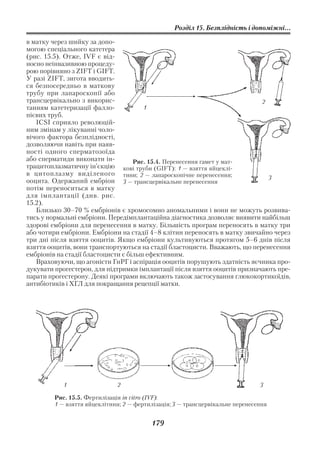 Розділ 15. Безплідність і допоміжні...

в матку через шийку за допо
могою спеціального катетера
(рис. 15.5). Отже, IVF є від
носно неінвазивною процеду
рою порівняно з ZIFT і GIFT.
У разі ZIFT, зигота вводить
ся безпосередньо в маткову
трубу при лапароскопії або
трансцервікально з викорис                                                  2
танням катетеризації фалло             1
пієвих труб.
   ICSI сприяло революцій
ним змінам у лікуванні чоло
вічого фактора безплідності,
дозволяючи навіть при наяв
ності одного сперматозоїда
або сперматиди виконати ін          Рис. 15.4. Перенесення гамет у мат
трацитоплазматичну ін’єкцію кові труби (GIFT): 1 — взяття яйцеклі
в цитоплазму виділеного тини; 2 — лапароскопічне перенесення;
                                                                              3
ооцита. Одержаний ембріон 3 — трансцервікальне перенесення
потім переноситься в матку
для імплантації (див. рис.
15.2).
   Близько 30–70 % ембріонів є хромосомно аномальними і вони не можуть розвива
тись у нормальні ембріони. Передімплантаційна діагностика дозволяє виявити найбільш
здорові ембріони для перенесення в матку. Більшість програм переносять в матку три
або чотири ембріони. Ембріони на стадії 4–8 клітин переносять в матку звичайно через
три дні після взяття ооцитів. Якщо ембріони культивуються протягом 5–6 днів після
взяття ооцитів, вони транспортуються на стадії бластоцисти. Вважають, що перенесення
ембріонів на стадії бластоцисти є більш ефективним.
   Враховуючи, що агоністи ГнРГ і аспірація ооцитів порушують здатність яєчника про
дукувати прогестерон, для підтримки імплантації після взяття ооцитів призначають пре
парати прогестерону. Деякі програми включають також застосування глюкокортикоїдів,
антибіотиків і ХГЛ для покращання рецепції матки.




           1                 2                                                 3

        Рис. 15.5. Фертилізація in vitro (IVF):
        1 — взяття яйцеклітини; 2 — фертилізація; 3 — трансцервікальне перенесення


                                         179
 