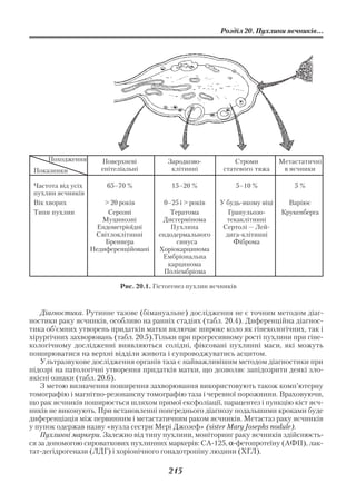 Розділ 20. Пухлини яєчників...




     Походження        Поверхневі           Зародково            Строми         Метастатичні
 Показники             епітеліальні          клітинні        статевого тяжа      в яєчники

 Частота від усіх       65–70 %              15–20 %             5–10 %             5%
 пухлин яєчників
 Вік хворих             > 20 років         0–25 і > років   У будь якому віці     Варіює
 Типи пухлин             Серозні             Тератома          Гранульозо       Крукенберга
                       Муцинозні          Дисгермінома        текаклітинні
                     Ендометріоїдні          Пухлина         Сертолі — Лей
                     Світлоклітинні      ендодермального      дига клітинні
                        Бреннера              синуса            Фіброма
                    Недиференційовані    Хоріокарцинома
                                          Ембріональна
                                            карцинома
                                           Поліембріома

                             Рис. 20.1. Гістогенез пухлин яєчників



    Діагностика. Рутинне тазове (бімануальне) дослідження не є точним методом діаг
ностики раку яєчників, особливо на ранніх стадіях (табл. 20.4). Диференційна діагнос
тика об’ємних утворень придатків матки включає широке коло як гінекологічних, так і
хірургічних захворювань (табл. 20.5).Тільки при прогресивному рості пухлини при гіне
кологічному дослідженні виявляються солідні, фіксовані пухлинні маси, які можуть
поширюватися на верхні відділи живота і супроводжуватись асцитом.
    Ультразвукове дослідження органів таза є найважливішим методом діагностики при
підозрі на патологічні утворення придатків матки, що дозволяє запідозрити деякі зло
якісні ознаки (табл. 20.6).
    З метою визначення поширення захворювання використовують також комп’ютерну
томографію і магнітно резонансну томографію таза і черевної порожнини. Враховуючи,
що рак яєчників поширюється шляхом прямої ексфоліації, парацентез і пункцію кіст яєч
ників не виконують. При встановленні попереднього діагнозу подальшими кроками буде
диференціація між первинним і метастатичним раком яєчників. Метастаз раку яєчників
у пупок одержав назву «вузла сестри Мері Джозеф» (sister Mary Josephs nodule).
    Пухлинні маркери. Залежно від типу пухлини, моніторинг раку яєчників здійснюєть
ся за допомогою сироваткових пухлинних маркерів: CA 125, α фетопротеїну (АФП), лак
тат дегідрогенази (ЛДГ) і хоріонічного гонадотропіну людини (ХГЛ).

                                            215
 