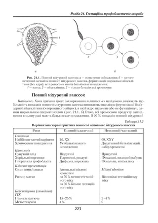 Розділ 21. Гестаційна трофобластична хвороба




                               1




                                                   2                     3



              а                                                      б

         Рис. 21.1. Повний міхуровий занесок: а — схематичне зображення; б — цитоге
      нетичний механізм повного міхурового занеска, фертилізація порожньої яйцеклі
      тини (без ядра); всі хромосоми мають батьківське походження;
         1 — матка; 2 — яйцеклітина; 3 — тільки батьківські хромосоми

            Повний міхуровий занесок
   Патогенез. Хоча причина цього захворювання залишається невідомою, вважають, що
більшість випадків повного міхурового занеска виникають внаслідок фертилізації без’я
дерної яйцеклітини («порожнього яйця»), в якій ядро втрачене або не функціонує, од
ним нормальним сперматозоїдом (рис. 21.1, б).Отже, всі хромосоми продукту заплід
нення в цьому разі мають батьківське походження. В 90 % випадків повний міхуровий
                                                                       Таблиця 21.2
            Порівняльна характеристика повного і неповного міхурового занеска
             Риси                  Повний/класичний            Неповний/частковий
 Генетика
 Найбільш частий каріотип      46, XX                        69, XXY
 Хромосомне походження         Усі батьківського             Додатковий батьківський
                               походження                    набір хромосом
 Патологія
 Супутній плід                 Відсутній                     Присутній
 Хоріальні ворсинки            Гідропічні, роздуті           Фокальні, видимий набряк
 Гіперплазія трофобласта       Дифузна, виражена             Фокальна, мінімальна
 Клінічна презентація
 Симптоми/ознаки               Аномальні піхвові             Missed abortion
                               кровотечі
 Розмір матки                  на 50 % менше гестацій        Відповідає гестаційному
                               ного віку                     віку
                               на 30 % більше гестацій
                               ного віку
 Персистуюча (злоякісна)
 ГТХ
 Неметастазуюча                15–25 %                       3–4 %
 Метастазуюча                  4%                            0

                                          223
 
