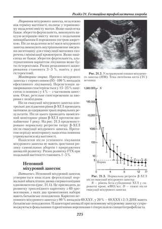 Розділ 21. Гестаційна трофобластична хвороба

    Лікування міхурового занеска, незалежно
віж терміну вагітності, полягає у терміново
му видаленні вмісту матки. Якщо пацієнтка
бажає зберегти фертильність, виконують ва
куум аспірацію вмісту матки з подальшим
вишкрібанням її порожнини гострою кюрет
кою. Після видалення всієї маси міхурового
занеска виконують внутрішньовенне введен
ня окситоцину для стимуляції маткових ско
рочень і мінімізації крововтрати. Якщо паці
єнтка не бажає зберегти фертильність, аль
тернативним варіантом лікування може бу
ти гістеректомія. Ризик рецидивного захво
рювання становить 3–5 %, навіть у разі
гістеректомії.                                    Рис. 21.2. Ультразвукові ознаки міхурово
    Моніторинг хворих. Прогноз міхурового     го занеска (HM). Тека лютеїнова кіста (ТC)
занеска є сприятливим (95–100 % випадків      яєчника
ефективного лікування). Персистенція за
хворювання спостерігається у 15–25 % паці               N
єнток із повним і у 4 % — з частковим занес
ком. Отже, ретельне спостереження за хво
рими є необхідним.
    Після евакуації міхурового занеска кон
трольні дослідження рівня β ХГЛ проводять
щотижня до одержання трьох нормальних ре
зультатів. Після цього проводять щомісяч
ний моніторинг рівня β ХГЛ протягом що
найменше 1 року. На рис. 21.3 продемонст
ровано нормальну регресію титру β ХГЛ
після евакуації міхурового занеска. Протя
гом періоду моніторингу пацієнтка повинна
утримуватися від вагітності.
    Пацієнтки після успішного лікування
міхурового занеска не мають зростання ри
зику самовільних абортів і природжених
аномалій розвитку. Ризик розвитку ГТХ при
подальшій вагітності становить 1–5 %.

                                                      Норма
      Неповний
      міхуровий занесок
                                                                                        D
   Патогенез. Неповний міхуровий занесок
утворюється внаслідок фертилізації нор            Рис. 21.3. Нормальна регресія β ХГЛ
                                              після евакуації міхурового занеска:
мальної яйцеклітини двома сперматозоїдами         N — рівень бета субодиниці ХГЛ у си
одномоментно (рис. 21.4). Це призводить до    роватці крові, мМО/мл; D — тижні після
розвитку триплоїдного каріотипу з 69 хро      евакуації міхурового занеска
мосомами, з яких два хромосомних набори
мають батьківське походження. Каріотип не
повного міхурового занеска у 80 % випадків 69,XXY, у 20 % — 69,ХХХ і 2/3 ДНК мають
батьківське походження. Плацентарні аномалії при неповному міхуровому занеску супро
воджуються фокальними гідропічними ворсинками і гіперплазією синцитіотрофобласта.

                                        225
 