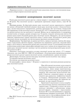 Акушерство і гінекологія. Том 2

   Лікування полягає у локальній ексцизії зони запалення, інколи з екстенсивним вида
ленням субареолярних молочних проток.


             Злоякісні захворювання молочної залози
   Ризик раку молочної залози зростає з віком хворих і є максимальним у жінок близь
ко 50 років. Рак молочної залози є провідною причиною смерті жінок у віці 40–55
років.
   Фактори ризику. До факторів ризику раку молочної залози зараховують старший
вік жінки, обтяжений сімейний анамнез щодо раку молочної залози і гінекологічного
раку, вплив іонізуючого опромінення, атипову протокову або часточкову гіперплазію
або карциному in situ молочної залози. Близько 0,4–0,5 % випадків раку молочної зало
зи діагностуються під час вагітності і лактації. Жінки, що не народжували, із синдромом
полікістозних яєчників, раннім менархе (до 12 років), пізньою менопаузою (після 55
років) також мають більший ризик раку молочної залози. Вважають, що застосування
замісної гормональної терапії протягом понад 5 років може збільшувати ризик раку
молочної залози, на відміну від застосування оральних контрацептивів.
   Профілактика. Такі фактори, як рання вагітність, тривала лактація, хімічна або хірур
гічна стерилізація, фізичні вправи, утримання від вживання алкоголю, низький вміст
жиру в дієті можуть зменшувати ризик раку молочної залози. Селективний антагоніст
естрогенових рецепторів тамоксифен використовується у жінок після хірургічного ліку
вання раку молочної залози і зменшує частоту розвитку контрлатерального раку молоч
ної залози на 40 %.
   Онкогенез. Генетична схильність до раку молочної залози має місце у 5 % хворих.
Доведено, що гени BRCA1 і BRCA2 асоційовані з білатеральним пременопаузальним
раком молочної залози і раком молочної залози, асоційованим з раком яєчників.
   Діагностика. Рутинна діагностика раку молочної залози включає таку тріаду:
   1) самообстеження молочних залоз;
   2) клінічне дослідження молочних залоз;
   3) мамографія у жінок віком > 40 років і у пацієнток із високим ризиком розвитку
раку молочної залози.
                                                 При обстеженні молочних залоз можуть
                                             мати місце утворення в молочній залозі, що
                                             пальпуються, зміни шкіри (еритематозна,
                                             тепла), виділення із соска, його ретракція або
                                             інверсія, або симптоми метастатичної хво
                                             роби. Симптом «лимонної кірки» на шкірі
                                             свідчить про дермальну лімфатичну інвазію
                                             та блокаду. Поверхневий епідерміс соска
                                             може бути екзематозним або вкритим ви
                                             разками, як при хворобі Педжета.
       15 %     50 %
                                                 Кров’янисті виділення із соска потребу
                                             ють виключення діагнозу інвазивного папі
        6 % 11 %                             лярного раку. Утворення в залозі, що паль
                             18 %            пуються, звичайно є неболючими, непра
                                             вильної форми, твердими і нерухливими.
                                             Близько 50 % пухлин виникають у верхньо
                                             зовнішньому квадранті залози (рис. 22.2). Ці
                                             пухлини часто є мультифокальними, муль
   Рис. 22.2. Типова локалізація раку молоч  тицентричними і білатеральними.
ної залози

                                          236
 