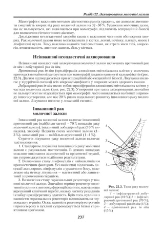 Розділ 22. Захворювання молочної залози

    Мамографія є важливим методом діагностики ранніх уражень, що дозволяє зменши
ти смертність хворих від раку молочної залози на 32–50 %. Ураження молочних залоз,
що не пальпуються, які виявляються при мамографії, підлягають аспіраційній біопсії
для визначення гістологічного діагнозу.
    Дослідження метастатичної хвороби також є важливою частиною обстеження хво
рих. Рак молочної залози може метастазувати у кістки, легені, печінку, плевру, мозок і
лімфатичні вузли. Тому важливо виявити такі симптоми, як втрата маси тіла, анорек
сія, втомлюваність, диспное, кашель, біль у кістках.

            Неінвазивні неопластичні захворювання
    Неінвазивні неопластичні захворювання молочної залози включають протоковий рак
in situ і лобулярний рак in situ.
    Протоковий рак in situ (проліферація злоякісних епітеліальних клітин у молочних
протоках) звичайно візуалізується при мамографії завдяки наявності кальцифікатів (рис.
22.3). Діагноз підтверджується при аспіраційній або ексцизійній біопсії. Лікування поля
гає у хірургічній ексцизії всіх мікрокальцифікатів у широких межах здорових тканин.
    Лобулярний рак in situ являє собою проліферацію злоякісних епітеліальних клітин у
частках молочних залоз (див. рис. 22.3). Утворення при таких захворюваннях звичайно
не пальпується і не візуалізується при мамографії і часто виявляється на біопсії з приво
ду іншого утворення, але має 20 % ризик подальшого розвитку інвазивного раку молоч
ної залози. Лікування полягає у локальній ексцизії.

            Інвазивний рак
            молочної залози
    Інвазивний рак молочної залози включає інвазивний
протоковий рак (найбільш частий – 70 % випадків раку
                                                           4
молочної залози), інвазивний лобулярний рак (10 % ви
падків), хворобу Педжета соска молочної залози (1–
3 %), запальний рак — найбільш агресивний (1–4 %).
    Стратегія лікування раку молочної залози включає       3
такі положення:
    1. Стандартом лікування інвазивного раку молочної
залози є радикальна мастектомія. В деяких випадках
                                                           2
можливе виконання лампектомії та променевої терапії,
що супроводжується подібними результатами.
    2. Визначення стану лімфовузлів є найважливішим
прогностичним фактором. Усі пацієнтки підлягають ди        1
секції аксилярних лімфовузлів з ураженого боку, неза
лежно від методу лікування — мастектомії або лампек
томії з променевою терапією.
    3. Визначення стану гормональних рецепторів у тка
нині молочної залози. Звичайно гормон рецептор пози
тивні пухлини є високодиференційованими, мають менш           Рис. 22.3. Типи раку молоч
агресивний клінічний перебіг, низьку частоту рецидивів    ної залози:
                                                               1 — інфільтруючий лобу
і слабку проліферативну здатність. Крім того, пухлини з
                                                          лярний рак (10 %); 2 — інфільт
наявністю гормональних рецепторів відповідають на гор     руючий протоковий рак (70 %);
мональну терапію. Отже, наявність рецепторів естрогенів   3 — лобулярний рак in situ (4 %);
і прогестерону в пухлині супроводжується більш спри       4 — протоковий рак in situ
ятливим прогнозом.                                        (15 %)

                                         237
 
