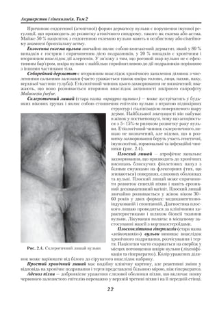 Акушерство і гінекологія. Том 2

    Причиною ендогенної (атопічної) форми дерматозу вульви є порушення імунної ре
гуляції, що призводить до розвитку атопічного синдрому, такого як екзема або астма.
Майже 50 % пацієнток з ендогенною екземою вульви мають в особистому або сімейно
му анамнезі бронхіальну астму.
    Екзогенна екзема вульви звичайно являє собою контактний дерматит, який у 80 %
випадків є гострим і спричиненим дією подразників, у 20 % випадків є хронічним і
вторинним внаслідок дії алергенів. У зв’язку з тим, що роговий шар вульви не є ефек
тивним бар’єром, шкіра вульви є найбільш сприйнятливою до дії подразників порівняно
з іншими частинами тіла.
    Себорейний дерматит є вторинним внаслідок хронічного запалення ділянок з чис
ленними сальними залозами (часто уражається також шкіра голови, лиця, пахви, паху,
верхньої частини тулуба). Етіологічний чинник цього захворювання не визначений; вва
жають, що воно розвивається вторинно внаслідок активності шкірного сапрофіту
Malassezia furfur.
    Склеротичний лишай (стара назва «крауроз вульви») — може зустрічатись у будь
яких вікових групах і являє собою стоншення епітелію вульви з втратою підшкірних
                                           структур і гіалінізацією поверхневого шару
                                           дерми. Найбільшої значущості він набуває
                                           в жінок у постменопаузі, тому що асоціюєть
                                           ся з 5–15% м ризиком розвитку раку вуль
                                           ви. Етіологічний чинник склеротичного ли
                                           шаю не визначений, але відомо, що в роз
                                           витку захворювання беруть участь генетичні,
                                           імунологічні, гормональні та інфекційні чин
                                           ники (рис. 2.4).
                                               Плоский лишай — атрофічне запальне
                                           захворювання, що призводить до хронічних
                                           висипань блискучих фіолетових папул з
                                           білими смужками на флексорних (тих, що
                                           згинаються) поверхнях, слизових оболонках
                                           та вульві. Плоский лишай може спричини
                                           ти розвиток синехій піхви і навіть ерозив
                                           ний десквамативний вагініт. Плоский лишай
                                           звичайно розвивається у жінок віком 30–
                                           60 років у двох формах: медикаментозно
                                           індукованій і спонтанній. Діагностика плос
                                           кого лишаю проводиться за клінічними ха
                                           рактеристиками і шляхом біопсії тканини
                                           вульви. Лікування полягає в місцевому за
                                           стосуванні мазей з кортикостероїдами.
                                               Плоскоклітинна гіперплазія (стара назва
                                           «лейкоплакія») вульви виникає внаслідок
                                           хронічного подряпання, розчісування і тер
                                           тя. Пацієнтки часто скаржаться на свербіж у
    Рис. 2.4. Склеротичний лишай вульви    місцях потовщення шкіри вульви (ліхеніфі
                                           кація та гіперкератоз). Колір уражених діля
нок може варіювати від білого до сіруватого внаслідок набряку.
    Простий хронічний лишай має подібну клінічну картину, але реактивні зміни у
відповідь на хронічне подряпання і тертя представлені більшою мірою, ніж гіперкератоз.
    Аденоз піхви — доброякісне ураження слизової оболонки піхви, що включає появу
червоного залозистого епітелію переважно у верхній третині піхви і на її передній стінці.

                                          22
 