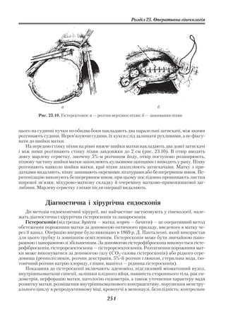 Розділ 23. Оперативна гінекологія




                    а                                                б

         Рис. 23.10. Гістеректомія: а — розтин верхівки піхви; б — зашивання піхви


цього на судинні пучки по обидва боки накладають два паралельні затискачі, між якими
розтинають судини. Перев’язуючи судини, їх кукси слід залишати рухливими, а не фіксу
вати до шийки матки.
   На передню стінку піхви на рівні нижче шийки матки накладають два довгі затискачі
і між ними розтинають стінку піхви завдовжки до 2 см (рис. 23.10). В отвір вводять
довгу марлеву серветку, змочену 5% м розчином йоду, отвір поступово розширюють,
піхвову частину шийки матки захоплюють кульовими щипцями і виводять у рану. Піхву
розтинають навколо шийки матки, краї піхви захоплюють затискачами. Матку з при
датками видаляють, піхву зашивають окремими лігатурами або безперервним швом. Пе
ритонізацію виконують безперервним швом, при цьому послідовно прошивають листки
широкої зв’язки, міхурово маткову складку й очеревину матково прямокишкової заг
либини. Марлеву серветку з піхви після операції видаляють.


            Діагностична і хірургічна ендоскопія
   До методів ендоскопічної хірургії, які найчастіше застосовують у гінекології, нале
жать діагностична і хірургічна гістероскопія та лапароскопія.
   Гістероскопія (від грецьк. hystera — матка, scopeo — бачити) — це оперативний метод
обстеження порожнини матки за допомогою оптичного приладу, введеного в матку че
рез її канал. Операцію вперше було виконано в 1869 р. Д. Панталеоні, який використав
для цього трубку із зовнішнім освітленням. Гістероскопія може бути звичайною пано
рамною і панорамною зі збільшенням. За допомогою гістерофіброскопа виконується гісте
рофіброскопія, гістерорезектоскопа — гістерорезектоскопія. Розтягнення порожнини мат
ки може виконуватися за допомогою газу (СО2 газова гістероскопія) або рідкого сере
довища (реополіглюкін, розчин декстранів, 5% й розчин глюкози, стерильна вода, ізо
тонічний розчин натрію хлориду, гліцин, манітол — рідинна гістероскопія).
   Показання до гістероскопії включають: аденоміоз, підслизовий міоматозний вузол,
внутрішньоматкові синехії, залишки плідного яйця, наявність стороннього тіла, рак ен
дометрія, перфорацію матки, патологію ендометрія, а також уточнення характеру вади
розвитку матки, розміщення внутрішньоматкового контрацептиву, порушення менстру
ального циклу в репродуктивному віці, кровотечі в менопаузі, безплідність; контрольне

                                           251
 