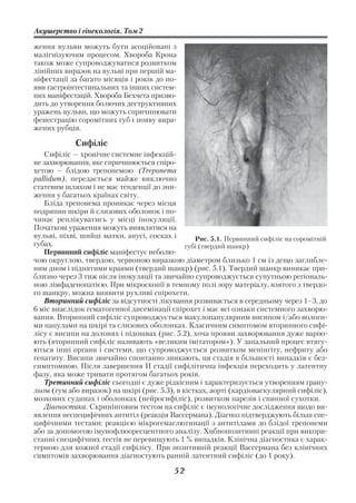 Акушерство і гінекологія. Том 2

ження вульви можуть бути асоційовані з
малігнізуючим процесом. Хвороба Крона
також може супроводжуватися розвитком
лінійних виразок на вульві при першій ма
ніфестації за багато місяців і років до по
яви гастроінтестинальних та інших систем
них маніфестацій. Хвороба Бехчета призво
дить до утворення болючих деструктивних
уражень вульви, що можуть спричинювати
фенестрацію соромітних губ і появу вира
жених рубців.

            Сифіліс
   Сифіліс — хронічне системне інфекцій
не захворювання, яке спричинюється спіро
хетою — блідою трепонемою (Treponema
pallidum), передається майже виключно
статевим шляхом і не має тенденції до зни
ження у багатьох країнах світу.
   Бліда трепонема проникає через місця
подряпин шкіри й слизових оболонок і по
чинає реплікуватись у місці інокуляції.
Початкові ураження можуть виявлятися на
вульві, піхві, шийці матки, анусі, сосках і       Рис. 5.1. Первинний сифіліс на соромітній
губах.                                         губі (твердий шанкр)
   Первинний сифіліс маніфестує неболю
чою округлою, твердою, червоною виразкою діаметром близько 1 см із дещо заглибле
ним дном і піднятими краями (твердий шанкр) (рис. 5.1). Твердий шанкр виникає при
близно через 3 тиж після інокуляції та звичайно супроводжується супутньою регіональ
ною лімфаденопатією. При мікроскопії в темному полі зору матеріалу, взятого з твердо
го шанкру, можна виявити рухливі спірохети.
   Вторинний сифіліс за відсутності лікування розвивається в середньому через 1–3, до
6 міс внаслідок гематогенної дисемінації спірохет і має всі ознаки системного захворю
вання. Вторинний сифіліс супроводжується макулопапулярним висипом і/або вологи
ми папулами на шкірі та слизових оболонках. Класичним симптомом вторинного сифі
лісу є висипи на долонях і підошвах (рис. 5.2), хоча прояви захворювання дуже варію
ють (вторинний сифіліс називають «великим імітатором»). У запальний процес втягу
ються інші органи і системи, що супроводжується розвитком менінгіту, нефриту або
гепатиту. Висипи звичайно спонтанно зникають, ця стадія в більшості випадків є без
симптомною. Після завершення ІІ стадії сифілітична інфекція переходить у латентну
фазу, яка може тривати протягом багатьох років.
   Третинний сифіліс сьогодні є дуже рідкісним і характеризується утворенням грану
льом (гум або виразок) на шкірі (рис. 5.3), в кістках, аорті (кардіоваскулярний сифіліс),
мозкових судинах і оболонках (нейросифіліс), розвитком парезів і спинної сухотки.
   Діагностика. Скринінговим тестом на сифіліс є імунологічне дослідження щодо ви
явлення неспецифічних антитіл (реакція Вассермана). Діагноз підтверджують більш спе
цифічними тестами: реакцією мікрогемаглютинації з антитілами до блідої трепонеми
або за допомогою імунофлюоресцентного аналізу. Хибнопозитивні реакції при викори
станні специфічних тестів не перевищують 1 % випадків. Клінічна діагностика є харак
терною для кожної стадії сифілісу. При позитивній реакції Вассермана без клінічних
симптомів захворювання діагностують ранній латентний сифіліс (до 1 року).

                                           52
 