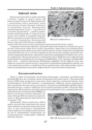 Розділ 5. Інфекції нижнього відділу...

            Інфекції піхви
    Вагінальні виділення в нормі звичайно
є білими і майже не мають запаху, рН
піхви в нормі близько 4,0. При мікроскопії
у вагінальному вмісті виявляють плоскі
епітеліальні клітини і бактерії, лейкоцити
та еритроцити відсутні. Домінантними
мікроорганізмами піхви є лактобацили
(палички Додерляйна) — аеробні грамне
гативні мікроорганізми. У піхві містяться
також інші аеробні й анаеробні бактерії.
Вагініт розвивається при порушенні балан
су власної мікрофлори (кандидозний                Рис. 5.7. Candida albicans
вагініт, бактеріальний вагіноз, атрофічний
вагініт) або внаслідок інвазії патогенами (трихомонадний вагініт тощо).
    Симптоми вагінальних інфекцій є провідною причиною звернень до гінеколога в усьо
му світі. Піхва являє собою тепле, вологе середовище, сприятливе для колонізації бага
тьох мікроорганізмів. Якщо будь який чинник порушує баланс нормальної мікрофлори
піхви (антибіотики, дієта, системні хвороби, вплив патогенів), надмірне зростання чис
ленних мікроорганізмів може спричинити симптоми захворювання (свербіж, біль, печін
ня, подразнення, збільшення виділень, неприємний запах). Найбільш часто інфекції піхви
спричинюються надмірним ростом кандид (Candida) (рис. 5.7) і гарднерел (Gardnerella),
менш часто — інвазією трихомонад (Trichomonas vaginalis). Гострі інфекції піхви зви
чайно не становлять діагностичних і лікувальних труднощів (антимікробна терапія). Але
у разі хронічного вагініту зі свербежем, болем, кровотечами і/або виразковими уражен
нями ці захворювання підлягають диференціації з малігнізуючими процесами.


            Бактеріальний вагіноз
   Піхва в нормі колонізована численними бактеріями, переважно лактобацилами
(Lactobacillus sp.), які, головним чином, підтримують рН піхви нижче 4. Бактеріальний
вагіноз (БВ) може розвиватися внаслідок зміни характеру домінантної флори піхви
(дисбактеріозу). Хоча БВ звичайно є полімікробним, найбільш частим мікроорганіз
мом, що виявляється при цьому ускладненні, є гарднерела (Gardnerella vaginalis). Бакте
ріальний вагіноз є однією з найбільш частих причин вагінітів (до 60 % випадків). Фак
тори ризику БВ включають низький соціально економічний статус, використання внут
рішньоматкових контрацептивів (ВМК), на
явність численних статевих партнерів і па
ління. Нерідко БВ спостерігається при вагі
тності і є фактором ризику передчасних по
логів (рис. 5.8).
   Діагностика. Багато пацієнток із БВ не
мають патологічних симптомів або відзна
чають наявність незначних вагінальних виді
лень. У разі симптомного захворювання
хворі скаржаться на профузні рідкі виділен
ня, що не спричинюють подразнення, але
супроводжуються неприємним «рибним»,
амінним запахом.
                                                Рис. 5.8. Бактеріальний вагіноз

                                         57
 