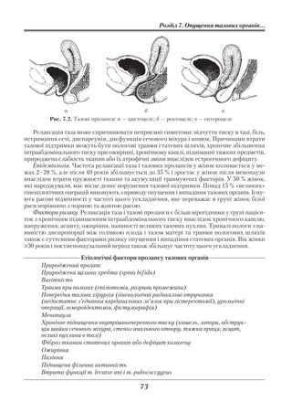Розділ 7. Опущення тазових органів...




               а                              б                             в
         Рис. 7.2. Тазові пролапси: а — цистоцелє; б — ректоцелє; в — ентероцелє

   Релаксація таза може спричинювати неприємні симптоми: відчуття тиску в тазі, біль,
нетримання сечі, диспареунія, дисфункція сечового міхура і кишок. Причинами втрати
тазової підтримки можуть бути пологові травми статевих шляхів, хронічне збільшення
інтраабдомінального тиску при ожирінні, хронічному кашлі, підніманні тяжких предметів,
природжена слабкість тканин або їх атрофічні зміни внаслідок естрогенного дефіциту.
   Епідеміологія. Частота релаксації таза і тазових пролапсів у жінок коливається у ме
жах 2–28 %, але після 40 років збільшується до 35 % і зростає у жінок після менопаузи
внаслідок втрати пружності тканин та акумуляції травмуючих факторів. У 50 % жінок,
які народжували, має місце деяке порушення тазової підтримки. Понад 15 % «великих»
гінекологічних операцій виконують з приводу опущення і випадіння тазових органів. Існу
ють расові відмінності у частоті цього ускладнення, яке переважає в групі жінок білої
раси порівняно з чорною та жовтою расою.
   Фактори ризику. Релаксація таза і тазові пролапси є більш вірогідними у групі пацієн
ток з хронічним підвищенням інтраабдомінального тиску внаслідок хронічного кашлю,
напруження, асциту, ожиріння, наявності великих тазових пухлин. Тривалі пологи з на
явністю диспропорції між голівкою плода і тазом матері та травми пологових шляхів
також є суттєвими факторами ризику опущення і випадіння статевих органів. Вік жінки
>30 років і постменопаузальний період також збільшує частоту цього ускладнення.
                     Етіологічні фактори пролапсу тазових органів
      Природжений пролапс
      Природжена щілина хребта (spina bifida)
      Вагітність
      Травма при пологах (епізіотомія, розриви промежини)
      Попередня тазова хірургія (гінекологічні радикальні втручання
      (недостатнє з’єднання кардинальних зв’язок при гістеректомії), урологічні
      операції, гемороїдектомія, фістулографія)
      Менопауза
      Хронічне підвищення внутрішньочеревного тиску (кашель, запори, обструк
      ція шийки сечового міхура, стеноз анального отвору, тяжка праця, асцит,
      великі пухлини в тазі)
      Фіброз тканин статевих органів або дефіцит колагену
      Ожиріння
      Паління
      Підвищена фізична активність
      Втрата функції m. levator ani і m. pubococcygeus

                                            73
 
