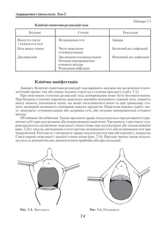 Акушерство і гінекологія. Том 2

                                                                              Таблиця 7.1
            Клінічні симптоми релаксації таза

        Больові                         Сечові                          Ректальні

 Відчуття тиску            Нетримання сечі                      Запори
 і тяжкості в тазі
 Біль внизу спини          Часте вимушене                       Болючий акт дефекації
                           сечовипускання
 Диспареунія               Зволікання сечовипускання            Неповний акт дефекації
                           Неповне випорожнення
                           сечового міхура
                           Рецидивна інфекція



            Клінічна маніфестація
    Анамнез. Клінічні симптоми релаксації таза варіюють залежно від включення в пато
логічний процес тих або інших тазових структур і ступеня пролапсу (табл. 7.1).
    При невеликих ступенях релаксації таза захворювання може бути безсимптомним.
При більших ступенях порушень пацієнтки звичайно відчувають тазовий тиск, тяжкість
внизу живота, випинання піхви, що може посилюватися вночі та при тривалому сто
янні, надмірній активності, підніманні важких предметів. Пацієнток нерідко турбує час
те, вимушене сечовипускання або затримка сечі, або неповне випорожнення сечового
міхура.
    Об’єктивне дослідження. Тазові пролапси краще візуалізуються при розкритті соро
мітних губ і при натужуванні або покашлюванні пацієнтки. Уретроцелє і цистоцелє суп
роводжуються опущенням передньої стінки піхви при натужуванні або покашлюванні
(рис. 7.3) і, інколи, витіканням сечі (стресове нетримання сечі, або нетримання сечі при
напруженні). Ректоцелє і ентероцелє краще візуалізуються при обстеженні у дзеркалах
Сімса окремо передньої і задньої стінок піхви (рис. 7.4). Пролапс матки також візуалі
зується за допомогою цих діагностичних прийомів або при пальпації.




   Рис. 7.3. Цистоцелє                           Рис. 7.4. Ректроцелє

                                          74
 