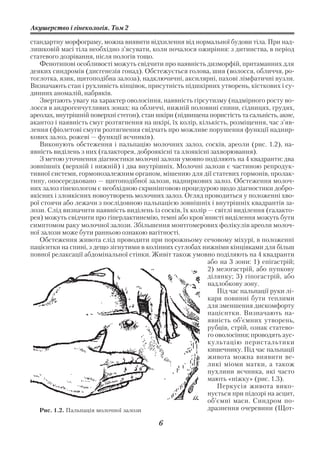 Акушерство і гінекологія. Том 2

стандартну морфограму, можна виявити відхилення від нормальної будови тіла. При над
лишковій масі тіла необхідно з’ясувати, коли почалося ожиріння: з дитинства, в період
статевого дозрівання, після пологів тощо.
   Фенотипові особливості можуть свідчити про наявність дизморфій, притаманних для
деяких синдромів (дисгенезія гонад). Обстежується голова, шия (волосся, обличчя, ро
тоглотка, язик, щитоподібна залоза), надключичні, аксилярні, пахові лімфатичні вузли.
Визначають стан і рухливість кінцівок, присутність підшкірних утворень, кісткових і су
динних аномалій, набряків.
   Звертають увагу на характер оволосіння, наявність гірсутизму (надмірного росту во
лосся в андрогенчутливих зонах: на обличчі, нижній половині спини, сідницях, грудях,
ареолах, внутрішній поверхні стегон), стан шкіри (підвищена пористість та сальність, акне,
акантоз і наявність смуг розтягнення на шкірі, їх колір, кількість, розміщення, час з’яв
лення (фіолетові смуги розтягнення свідчать про можливе порушення функції наднир
кових залоз, рожеві — функції яєчників).
   Виконують обстеження і пальпацію молочних залоз, сосків, ареоли (рис. 1.2), на
явність виділень з них (галакторея, доброякісні та злоякісні захворювання).
   З метою уточнення діагностики молочні залози умовно поділяють на 4 квадранти: два
зовнішніх (верхній і нижній) і два внутрішніх. Молочні залози є частиною репродук
тивної системи, гормонозалежним органом, мішенню для дії статевих гормонів, пролак
тину, опосередковано — щитоподібної залози, надниркових залоз. Обстеження молоч
них залоз гінекологом є необхідною скринінговою процедурою щодо діагностики добро
якісних і злоякісних новоутворень молочних залоз. Огляд проводиться у положенні хво
рої стоячи або лежачи з послідовною пальпацією зовнішніх і внутрішніх квадрантів за
лози. Слід визначити наявність виділень із сосків, їх колір — світлі виділення (галакто
рея) можуть свідчити про гіперлактинемію, темні або кров’янисті виділення можуть бути
симптомом раку молочної залози. Збільшення монтгомерових фолікулів ареоли молоч
ної залози може бути ранньою ознакою вагітності.
   Обстеження живота слід проводити при порожньому сечовому міхурі, в положенні
пацієнтки на спині, з дещо зігнутими в колінних суглобах нижніми кінцівками для більш
повної релаксації абдомінальної стінки. Живіт також умовно поділяють на 4 квадранти
                                                            або на 3 зони: 1) епігастрій;
                                                            2) мезогастрій, або пупкову
                                                            ділянку; 3) гіпогастрій, або
                                                            надлобкову зону.
                                                                Під час пальпації руки лі
                                                            каря повинні бути теплими
                                                            для зменшення дискомфорту
                                                            пацієнтки. Визначають на
                                                            явність об’ємних утворень,
                                                            рубців, стрій, ознак статево
                                                            го оволосіння; проводять аус
                                                            культацію перистальтики
                                                            кишечнику. Під час пальпації
                                                            живота можна виявити ве
                                                            ликі міоми матки, а також
                                                            пухлини яєчника, які часто
                                                            мають «ніжку» (рис. 1.3).
                                                                Перкусія живота вико
                                                            нується при підозрі на асцит,
                                                            об’ємні маси. Синдром по
   Рис. 1.2. Пальпація молочної залози                      дразнення очеревини (Щот

                                           6
 