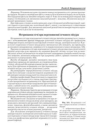 Розділ 8. Нетримання сечі

   Лікування. Основним методом лікування повного нетримання сечі є реконструктив
на хірургія. Більшість акушерських фістул можуть бути відновлені відразу після пологів.
Постхірургічні фістули звичайно оперують через 3–6 міс після попередньої операції. Цей
період є необхідним для зменшення запальної реакції і , можливо, збільшення васкуля
ризації травмованих тканин.
   При інфекціях сечових шляхів проводять курс етіотропної антибіотикотерапії; замі
сна терапія естрогенами має позитивний ефект у жінок у постменопаузі з симптомами
урогенітальної атрофії. Для зменшення запальної реакції інколи використовують корти
костероїди, хоча їх роль ще не визначена.

            Нетримання сечі при переповненні сечового міхура
    Нетримання сечі при переповненні сечового міхура звичайно розвивається у пацієн
ток з недостатністю функції детрузора (гіпотонія сечового міхура) або арефлексією
детрузора (втрата контрактильної функції сечового міхура, аконтрактильність). В ре
зультаті скорочення сечового міхура різко зменшуються або зникають, що призводить
до неповного випорожнення, затримки сечі та перерозтягнення сечового міхура (рис. 8.8).
    Причини нетримання сечі при переповненні сечового міхура внаслідок недостатності
функції детрузора дуже варіюють від затримки фекалій і впливу пухлин таза до вико
ристання деяких медикаментів чи неврологічних захворювань (хвороба нижніх мотор
них нейронів, автономна нейропатія при цукровому діабеті, травмах спинного мозку і
розсіяного склерозу) (табл. 8.6).
    Вихідні обструкції, звичайно виникають внаслідок
хірургічних процедур, які призводять до утворення рубців,
стенозу, обструкції або перекручування уретри, також мо                                 1
жуть бути причиною нетримання сечі при переповненні
сечового міхура, хоча вони є рідкісними у жінок.
    Післяопераційне перерозтягнення сечового міхура
може бути пов’язане з недіагностованою затримкою сечі
або використанням епідуральної чи спінальної анестезії.
    Клінічна маніфестація. Пацієнтки можуть скаржитися
на постійне підтікання сечі, а також симптоми стресово
го або імперативного нетримання сечі. При вихідній об
струкції можуть мати місце напруження при сечовипус
канні, слабкий потік сечі, затримка сечі або неповне ви
порожнення сечового міхура.
    Лікування. Лікувальна стратегія при нетриманні сечі при
переповненні сечового міхура спрямована на ліквідацію за
тримки сечі, збільшення контрактильної здатності сечово
го міхура, зменшення уретрального тиску замикання.
    Медикаментозне лікування нетримання сечі при пе
реповненні сечового міхура включає різні препарати, що
дозволяють зменшити уретральний тиск замикання (пра             Рис. 8.8. Нетримання сечі
зозин, теразозин, феноксибензамін), а також зменшити        при перерозтягненні сечового
вихідну резистентність сечового міхура — релаксанти міхура:
                                                                1 — нейрогенна втрата функ
поперечно смугастих м’язів (діазепам, дантролен).           ції детрузора спричинює ано
    Для збільшення контрактильності сечового міхура малії фази випорожнення, що
використовують холінергічні агенти (бетанехол). Само        призводить до перерозтягнення
катетеризація сечового міхура може також бути викори        сечового міхура. Сечовий міхур
стана для профілактики хронічної затримки сечі та вто       звільнюється внаслідок надмір
ринної інфекції.                                            ного розтягнення

                                           91
 