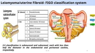 Fibroid Classification Ultrasound of gynecoloic pathologies.pptx