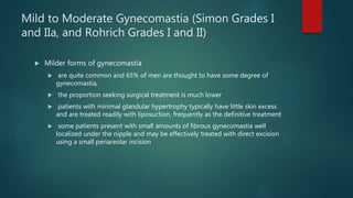 Mild to Moderate Gynecomastia (Simon Grades I
and IIa, and Rohrich Grades I and II)
 Milder forms of gynecomastia
 are quite common and 65% of men are thought to have some degree of
gynecomastia,
 the proportion seeking surgical treatment is much lower
 patients with minimal glandular hypertrophy typically have little skin excess
and are treated readily with liposuction, frequently as the definitive treatment
 some patients present with small amounts of fibrous gynecomastia well
localized under the nipple and may be effectively treated with direct excision
using a small periareolar incision
 