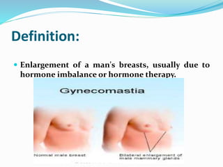 Definition:
 Enlargement of a man's breasts, usually due to
hormone imbalance or hormone therapy.
 