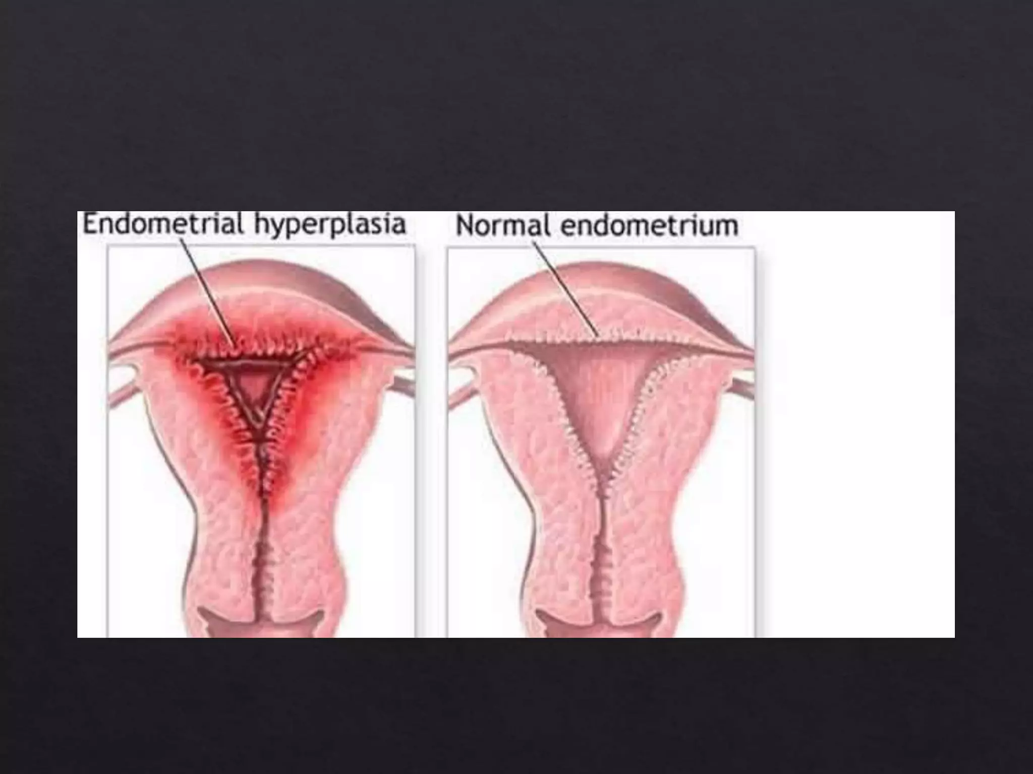 gynec ppt bhadra.pptx