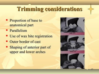 3737
Trimming considerationsTrimming considerations
 Proportion of base toProportion of base to
anatomical partanatomical part
 ParallelismParallelism
 Use of wax bite registrationUse of wax bite registration
 Outer border of castOuter border of cast
 Shaping of anterior part ofShaping of anterior part of
upper and lower archesupper and lower arches
 