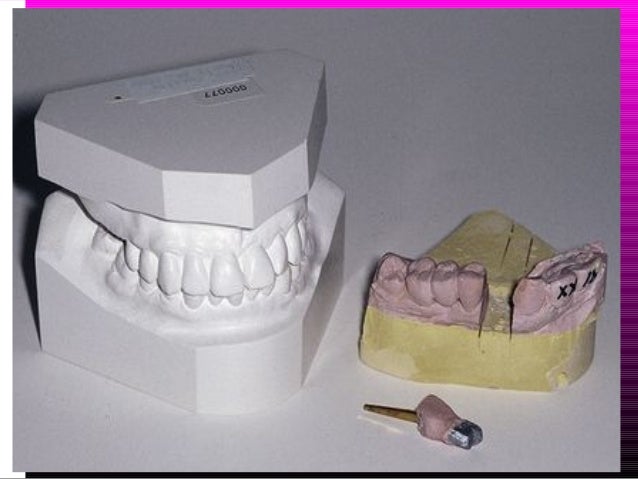 Gypsum products Gypsum products