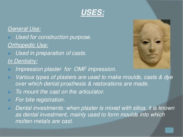 Gypsum products in Dentistry