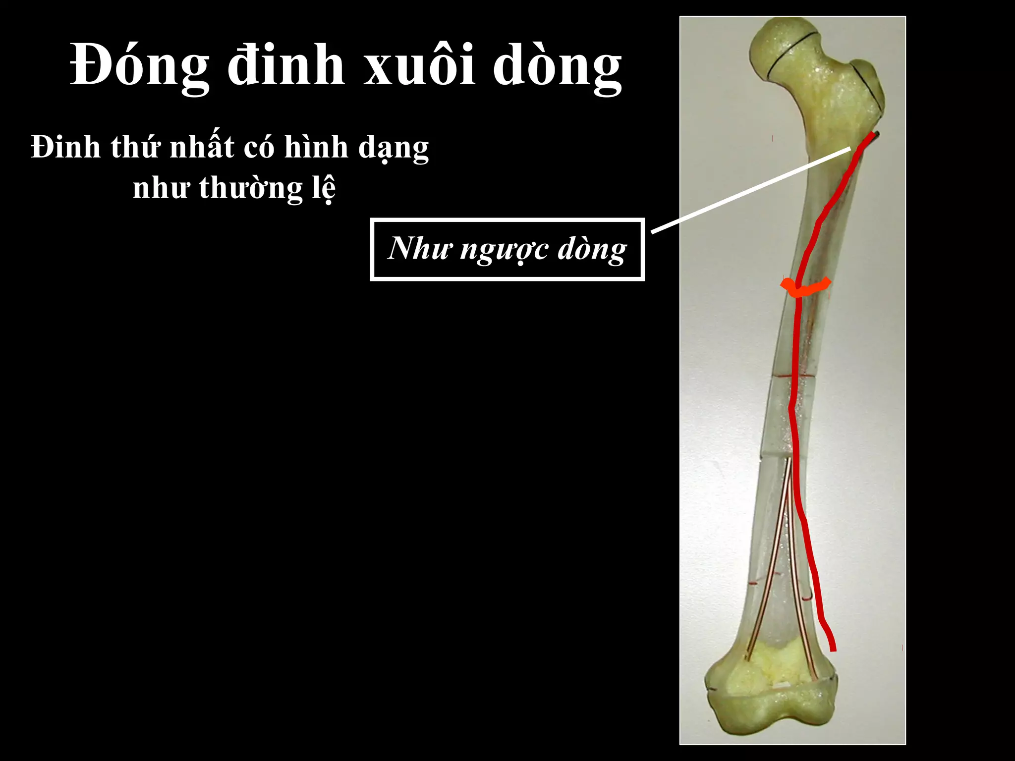 Đóng đinh xuôi dòng
Đinh thứ nhất có hình dạng
như thường lệ
Như ngược dòng
 