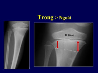 Trong > Ngoài
5 tháng
16 tháng
 