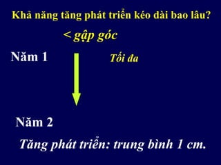 Khả năng tăng phát triển kéo dài bao lâu?
Năm 1
Năm 2
< gập góc
Tối đa
Tăng phát triển: trung bình 1 cm.
 