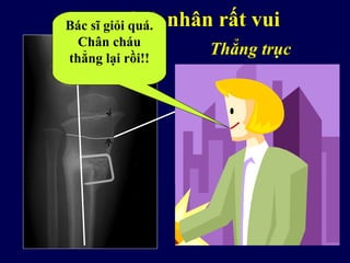 Nếu bạn cắt xương sửa trục
Thẳng trục
Khởi đầu, kết quả tốt
Original
growth arrest
line
Mẹ bệnh nhân rất vuiBác sĩ giỏi quá.
Chân cháu
thẳng lại rồi!!
 