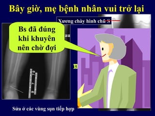 Tốt nhất, nên chờ đợi
2 ½ năm sau
15 năm sau
Xương chày hình chữ S
Sửa ở các vùng sụn tiếp hợp
Bây giờ, mẹ bệnh nhân vui trở lại
Bs đã đúng
khi khuyên
nên chờ đợi
 