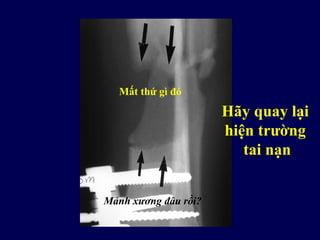 Mảnh xương đâu rồi?
Hãy quay lại
hiện trường
tai nạn
Mất thứ gì đó
 