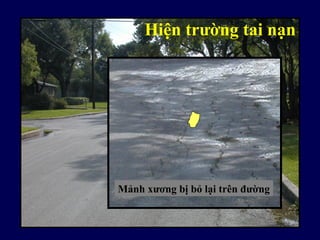 Hiện trường tai nạn
Mảnh xương bị bỏ lại trên đường
 