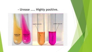 Urease Positive And Negative Bacteria Helicobacter Pylori & Campylobacter bacteria. | PPTX