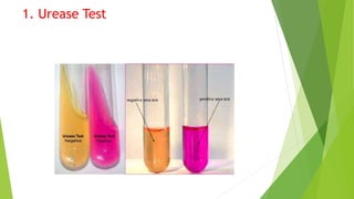 1. Urease Test
 