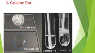 3. Catalase Test
 