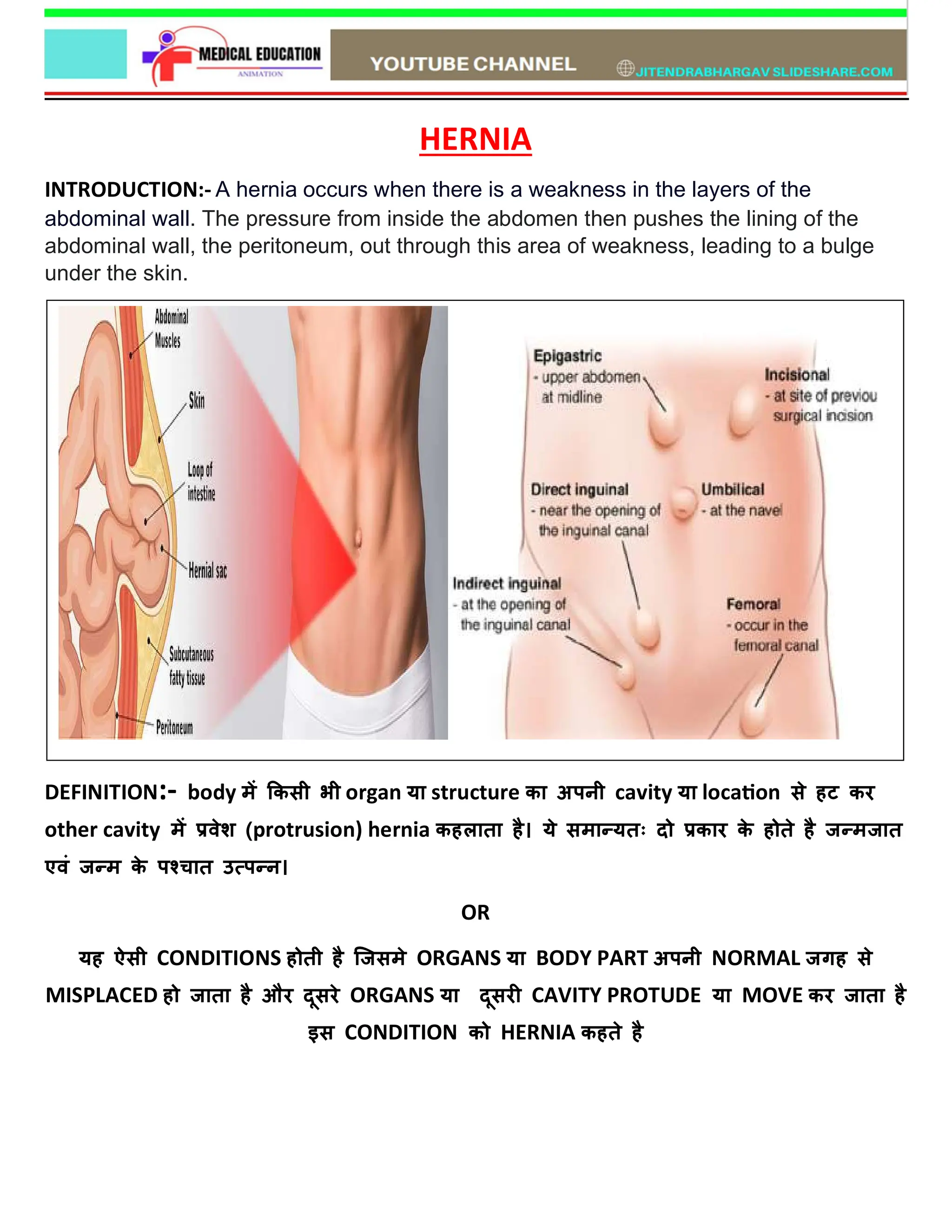 Hernia medical surgical nursing notes pdf Jitendra bhargav SlideShare | PDF