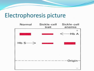 Electrophoresis picture
 