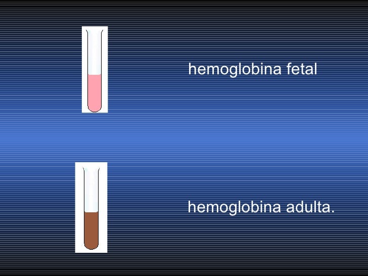 HEMORRAGIA DIGESTIVA ALTA EN EL NIñO